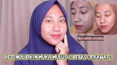 YG HARUS KALIAN TAU SEBELUM MENGGUNAKAN RETINOL YouTube