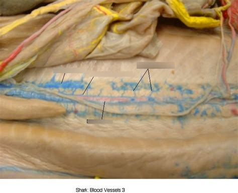 Shark Blood Vessels 3 Diagram | Quizlet