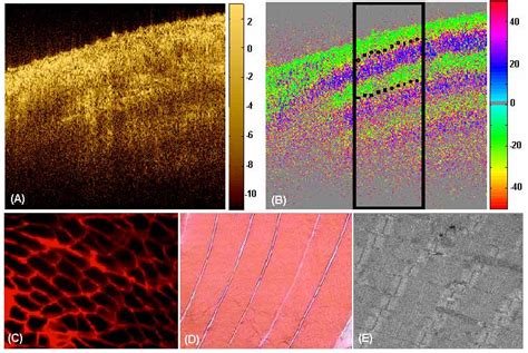 Non Exercised Wild Type Murine Skeletal Muscle A Structural Oct