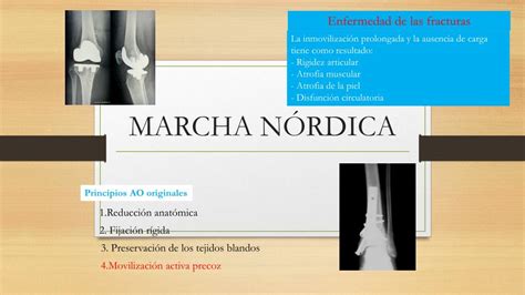 PPT MARCHA NÓRDICA PowerPoint Presentation free download ID 4283161