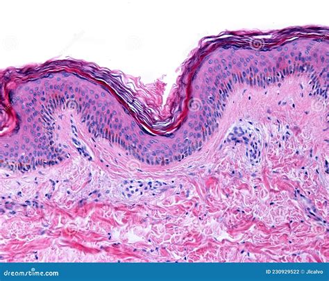 Histology Of Skin Stained With H&E Stock Photography | CartoonDealer.com #42769166