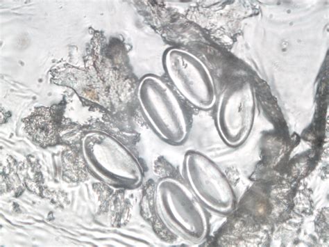 Enterobius Vermicularis X Mag Uk Neqas Set Of Parasite Flickr