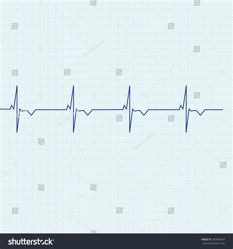 Blue Ekg Line On Graph Paper Background Heart Monitorheart Rhythm