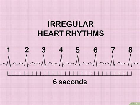 Grande Docena Emocionante Como Calcular La Frecuencia Cardiaca En Un Electrocardiograma