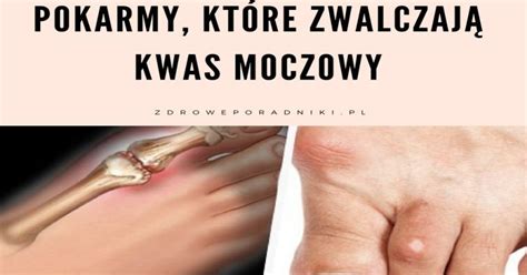 Poznaj pokarmy które zwalczają kwas moczowy in 2020 Kwas moczowy