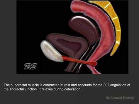 Anal Perianal Imaging Part 1 CT MRI Anatomy Dr Ahmed Esawy PDF Digestive Disorders