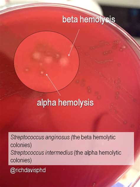 Blood Agar Alpha Beta Gamma