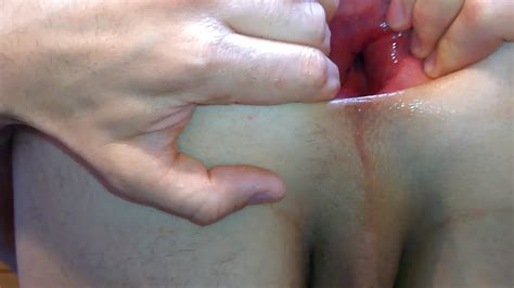 My Gaping Asshole Spread And Fist Nude Pics Xhamster