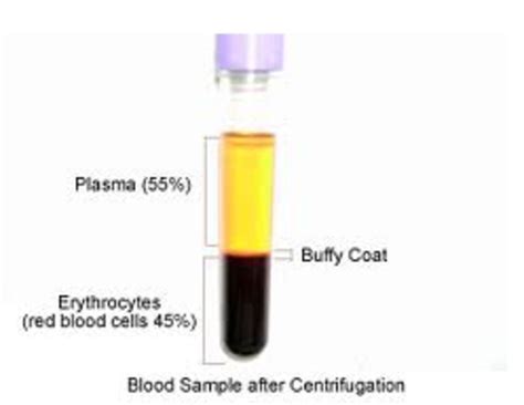 What Does Centrifuged Blood Look Like At Bonnie Latimer Blog