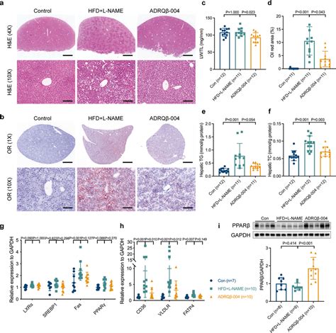 Adrq Vaccine Alleviated Hepatic Steatosis Elicited By Hfd