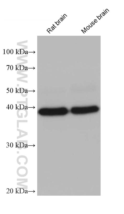 Syntaxin 18 Antibody 68220 1 Ig Proteintech