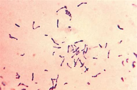 Diphtheroids - Definition, Classification, Structure, Pathogenesis ...