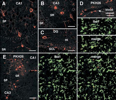 Figure 1 From The Intra Arterial Injection Of Microglia Protects