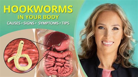 Hookworm Symptoms