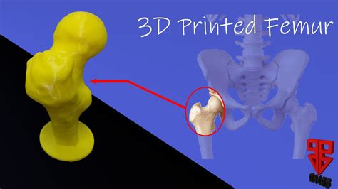 3d Printed Femur 3dgaags Youtube