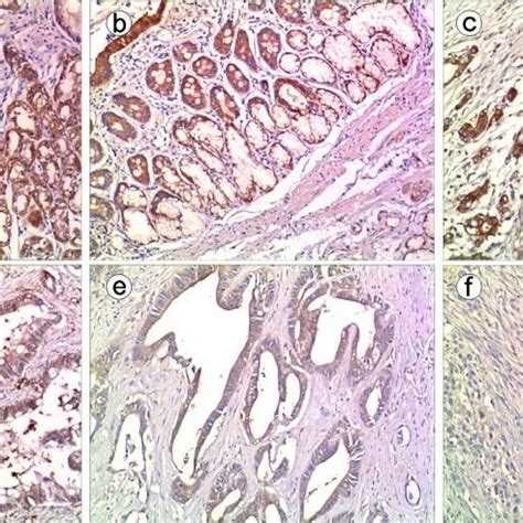 Immunohistochemical Staining Of Usp Proteins In Representa Tive