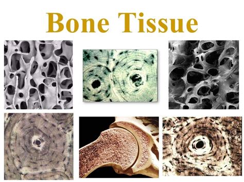 Bone tissue