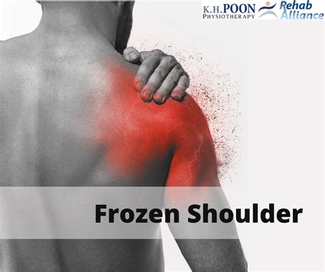 Physiotherapy 101 Frozen Shoulder Rehab Alliance Singapore Kh Poon Physiotherapy