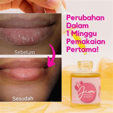 Jual Jiera Lip Serum Natural Pinkies Pelembab Pencerah Pemerah Bibir Original Jieraofficial 10ml