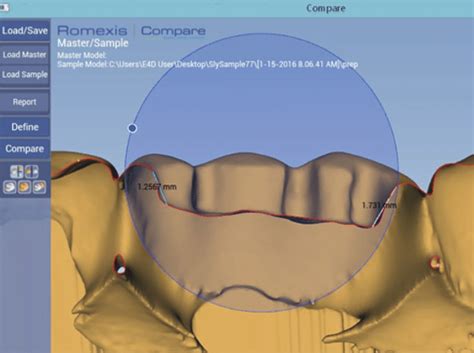 Mesiodistal Slice Of Scanned Class I Preparation Illustrating Pulpal Download Scientific