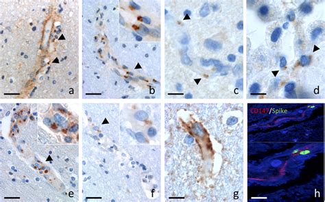 Golgi Localization Of Sars Cov Spike Protein And Interaction With