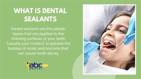 Ppt Major Benefits Of Dental Sealants Powerpoint Presentation Free