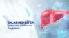 Liver Enlarged In Size Symptoms Causes And Treatments Ailbs India