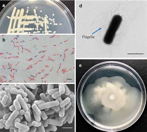 Bacillus Cereus Morphology And Arrangement