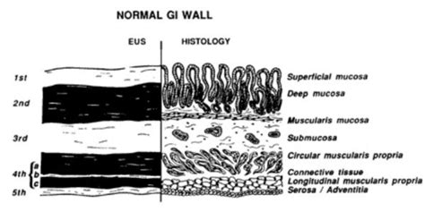 Correlation Between The Standard Five Eus Layers And Histological Download Scientific Diagram