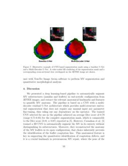 A Deep Learning Based And Fully Automated Pipeline For Regurgitant