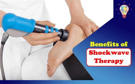 3 Benefits Of Shockwave Therapy Updated Ideas