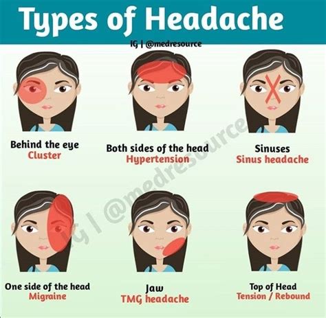 Types of Headache. in 2024 | Headache types, Interesting health facts ...