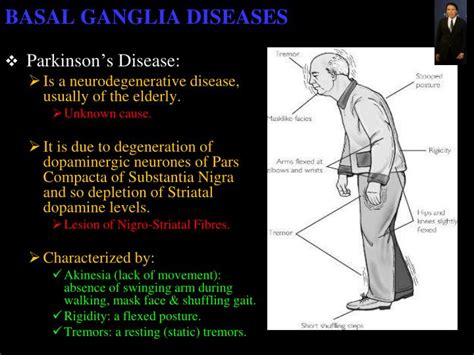 Basal Ganglia Disease