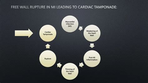 Cardiac Tamponade Ppt