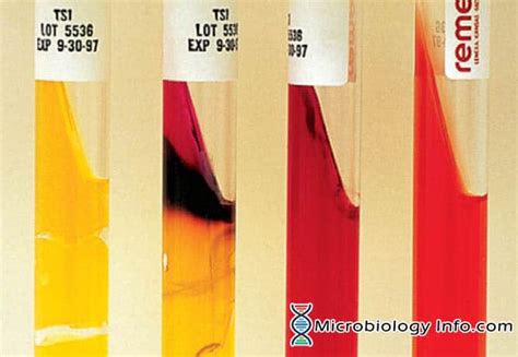 Triple Sugar Iron Tsi Agar Principle Results And 58 Off