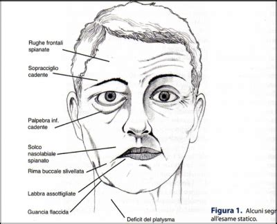 Pautas ENARM On X Ejercicios Para Parálisis Facial De 42 OFF