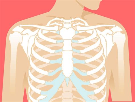 Broken Sternum: Symptoms, Car Accident, Treatment, and More