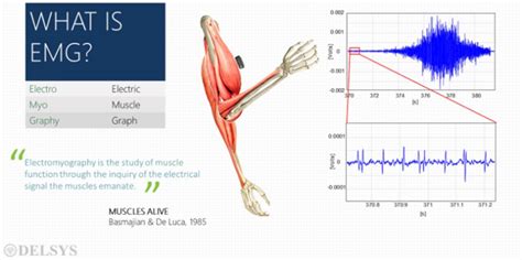 Electromyography Emg Basics Muscle Hypertrophy Denervation Rigor