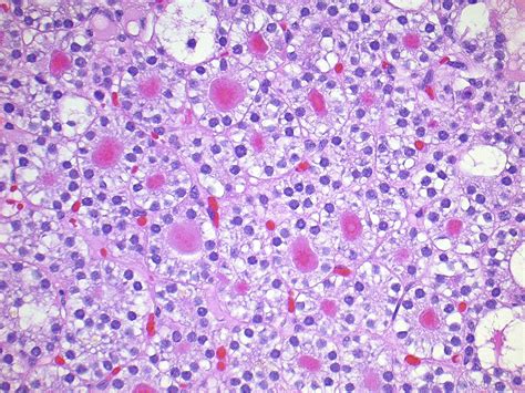 Histology Of Parathyroid Gland