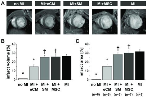 Quantification Of Infarct Size By Mri A Representative In Vivo T