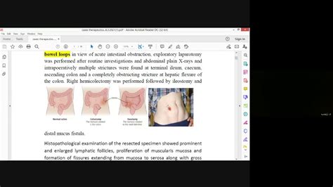 المحاضرة التاسعة نظري العلاجات cases part 1 YouTube