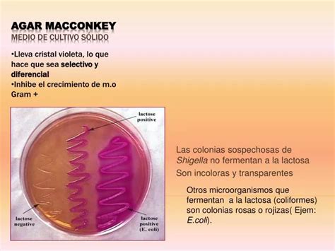 Shigella Macconkey Agar