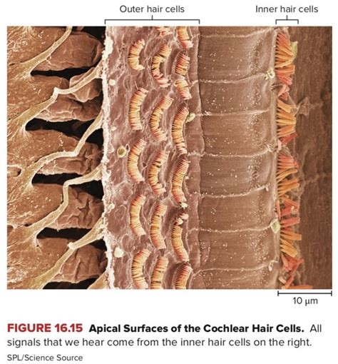 Damaged Cochlear Hair Cells