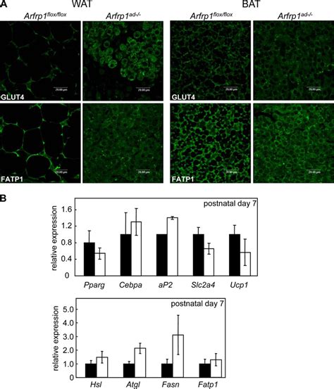 Expression Analysis Of Adipocyte Specific Genes In Adipose Tissues From