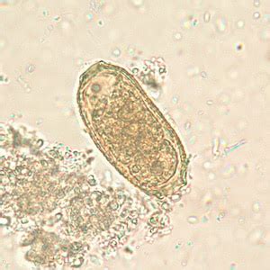 CDC - DPDx - Intestinal Capillariasis