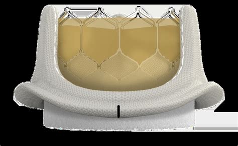 surgical valve selection edwards lifesciences