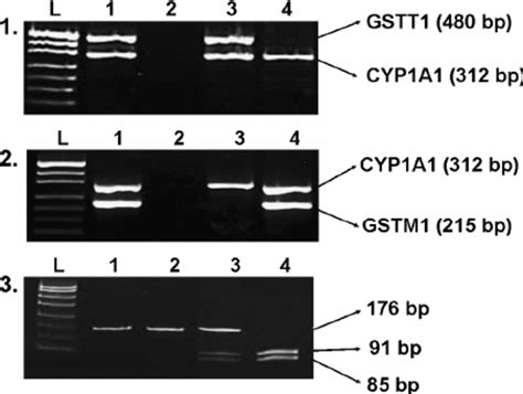 Gel Patterns Of Genotyping Of Gstt Gstm And Gstp Genes