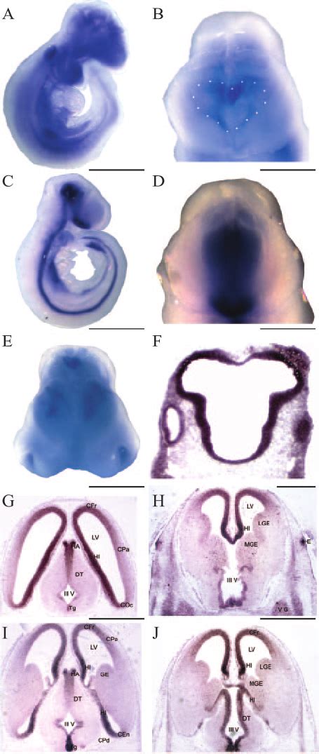 The Expression Patterns Of Tgif MRNA In E9 5 To E12 5 Wild Type Mouse