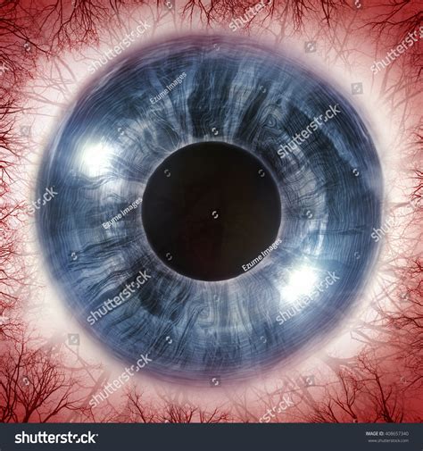 Red Bloodshot Eyeball Allergy Imagery 3d Stock Illustration 408657340