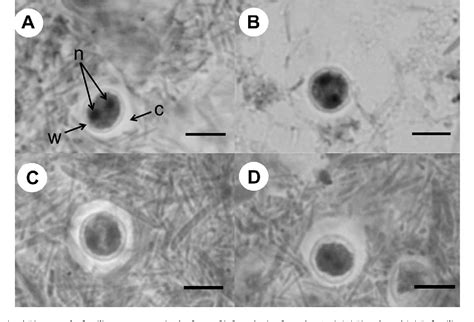 Figure 1 From Cyst Formation And Faecal Oral Transmission Of Dientamoeba Fragilis The Missing